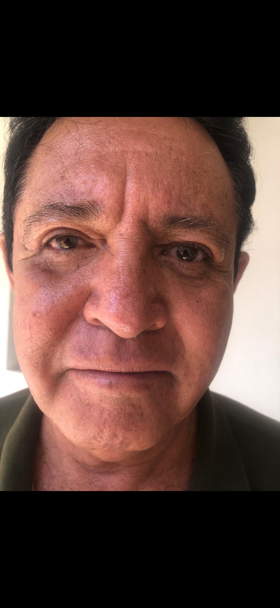 Dr. Torres en quirófano realizando cirugía endoscópica